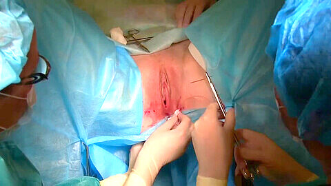Vista de cerca de una vagina depilada durante una cirugía